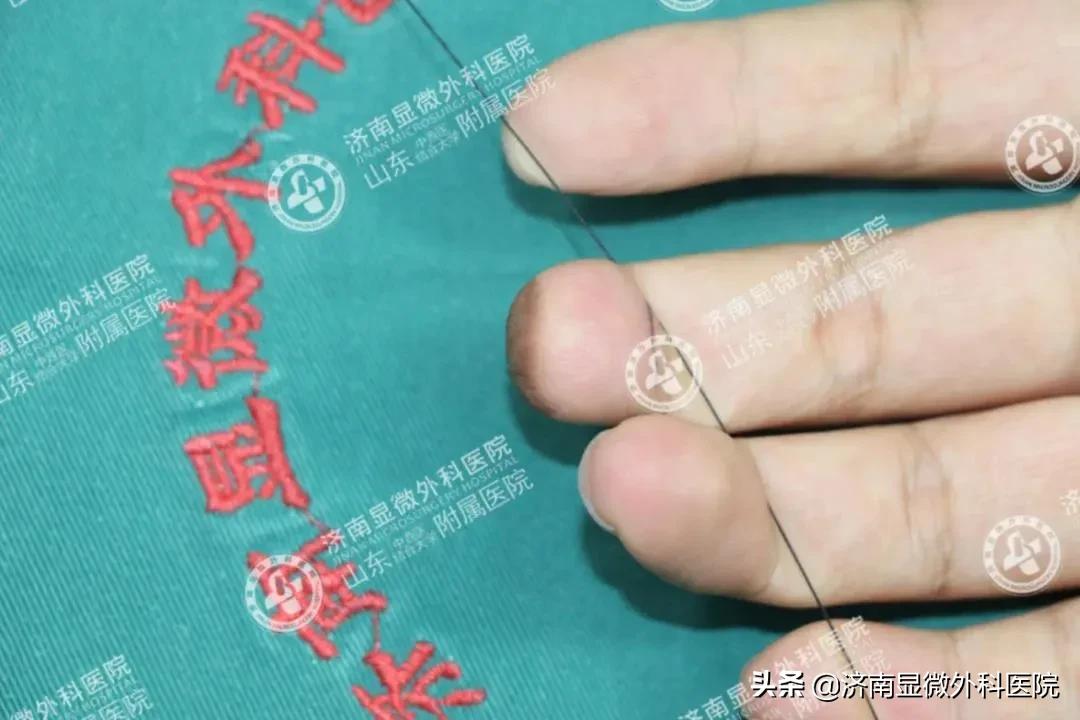 注意！失去一截手指不要灰心，这样做能重新复原它