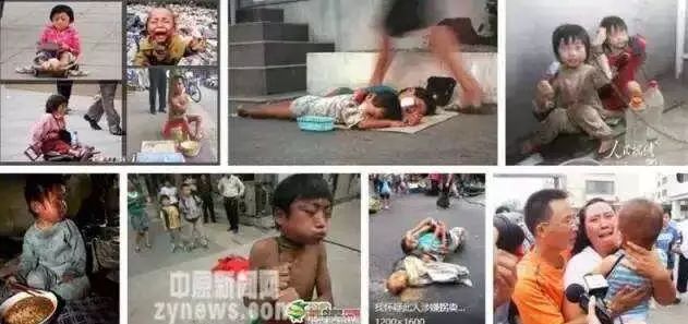 眼球被挖走了还能恢复么,眼球被挖走了还能恢复吗