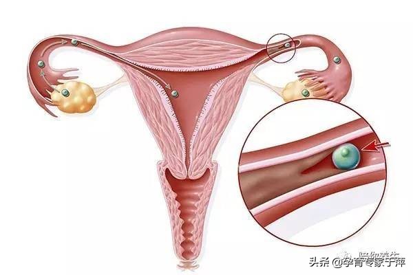 助孕专家于萍,青岛医生于萍视频