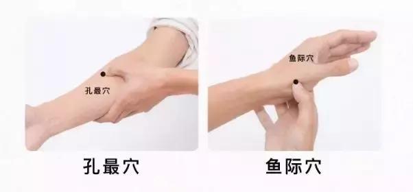 湿疹跟身体湿气重有关系吗,湿疹是因为体内湿气重造成的吗