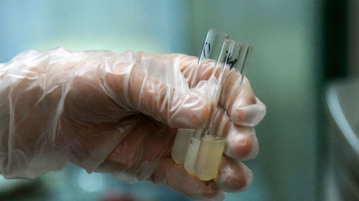 怎样才能检测小蝌蚪的数量,小蝌蚪成活率是多少合格