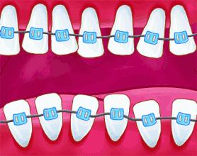 牙齿有黑三角会不会越来越严重,牙齿开始出现黑三角怎么办