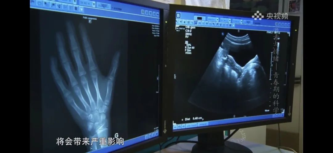 提前发育的孩子要注意什么,如何正确认识孩子提前发育