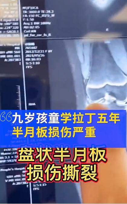 小孩高位截瘫功能锻炼,4岁孩子下腰瘫痪