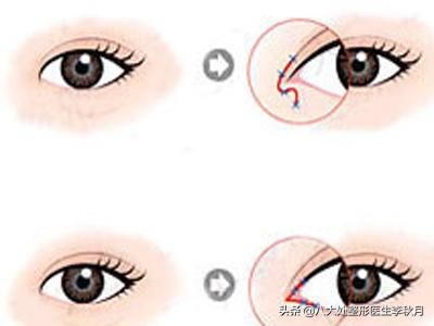 哪些男女明星双眼皮是割的,娱乐圈双眼皮男明星