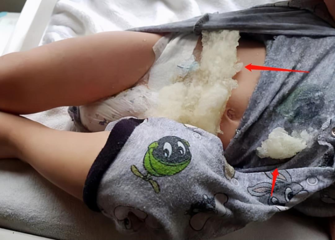 宝宝穿尿不湿一天要换几片,一片尿不湿宝宝穿两天