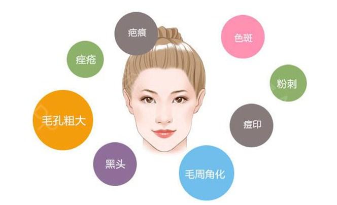 果酸化学换肤术的作用,果酸换肤变化过程