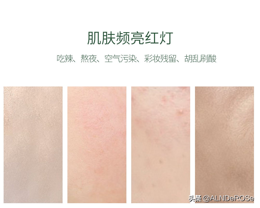 马鞭草酮迷迭香纯露适合什么肤质,马鞭草酮迷迭香纯露的功效与作用