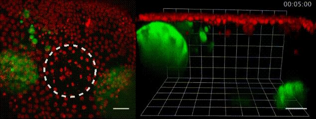 人体脂肪摄入,人体脂肪买卖违法吗