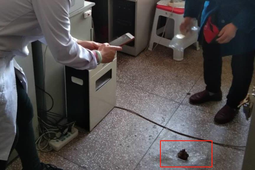 女子手术5年后体内取出纱布,女子手术5年体内取出纱布