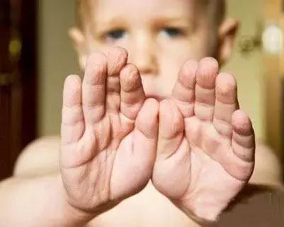 给干枯的身体洒水,给肌肤补充水分让皮肤放松