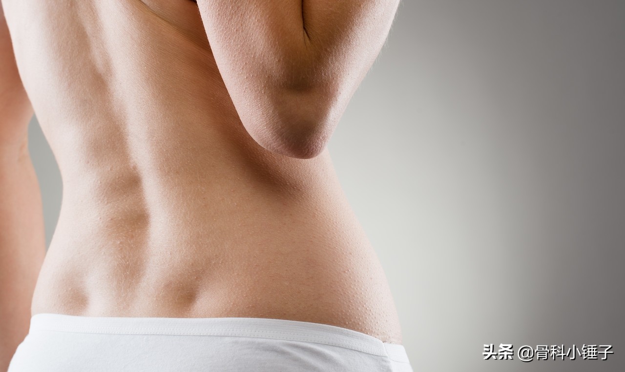 腰椎融合手术60天还痛正常吗,做完腰椎间盘突出手术还是很痛