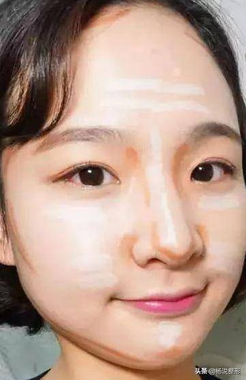 丑小鸭逆袭变天鹅,花3W做鼻整形值不值?术后200天恢复过程分享