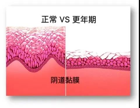 100亿活性乳酸菌,灭活乳酸杆菌