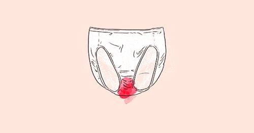 女性妇科癌症有哪些表现,妇科癌症早期10个症状