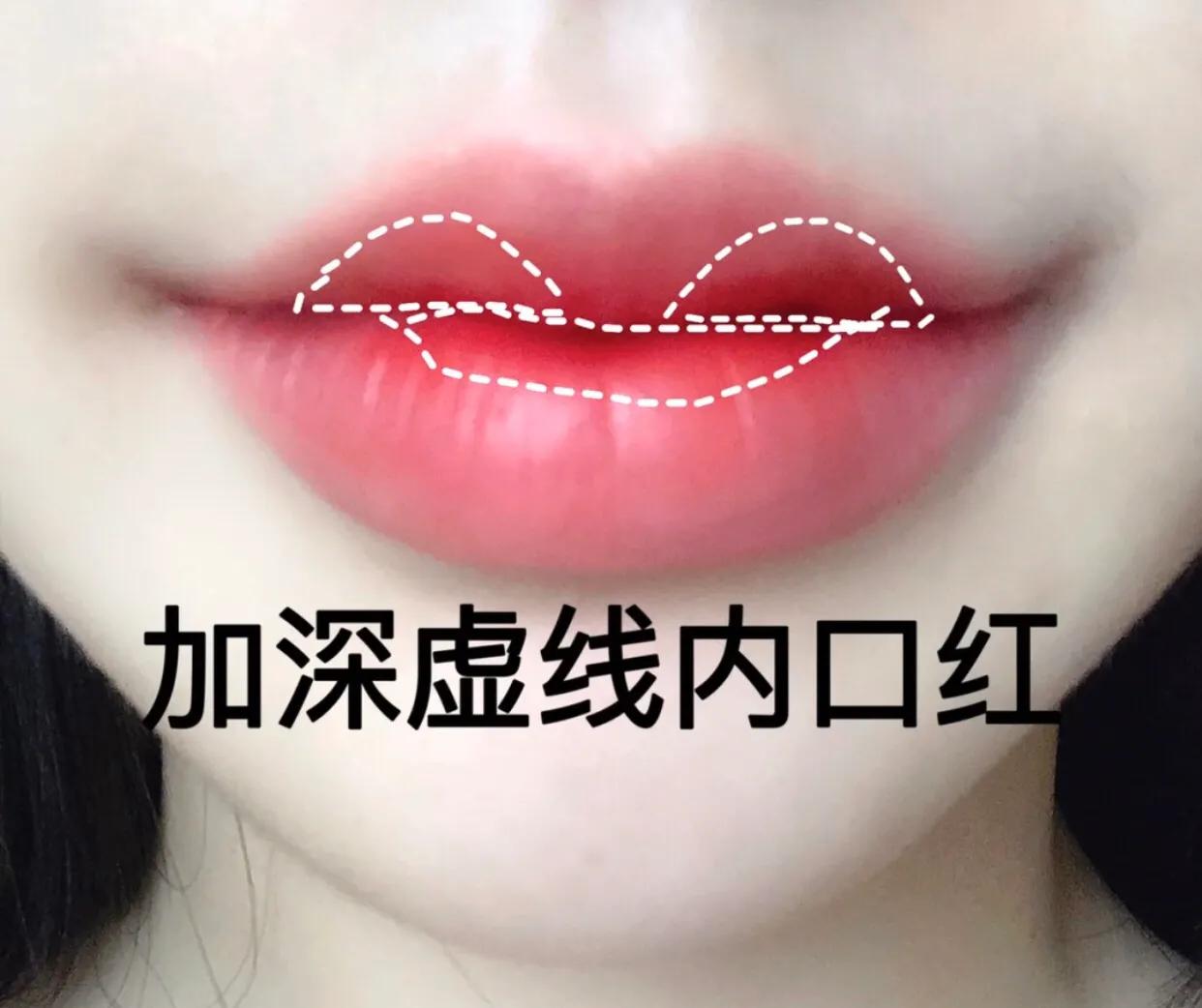 侧颜凸嘴怎么修,让侧脸变好看的方法