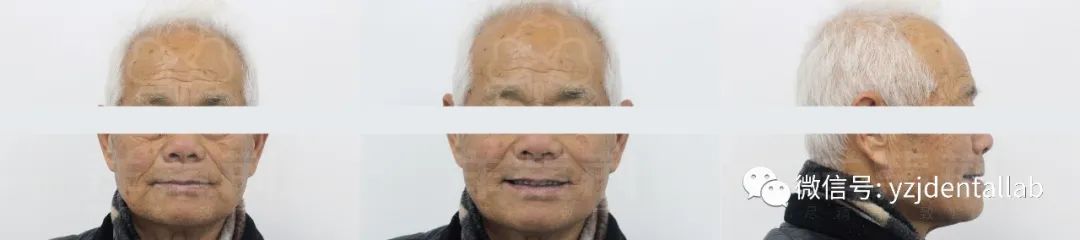 病例教学视频,病例分析操作技能