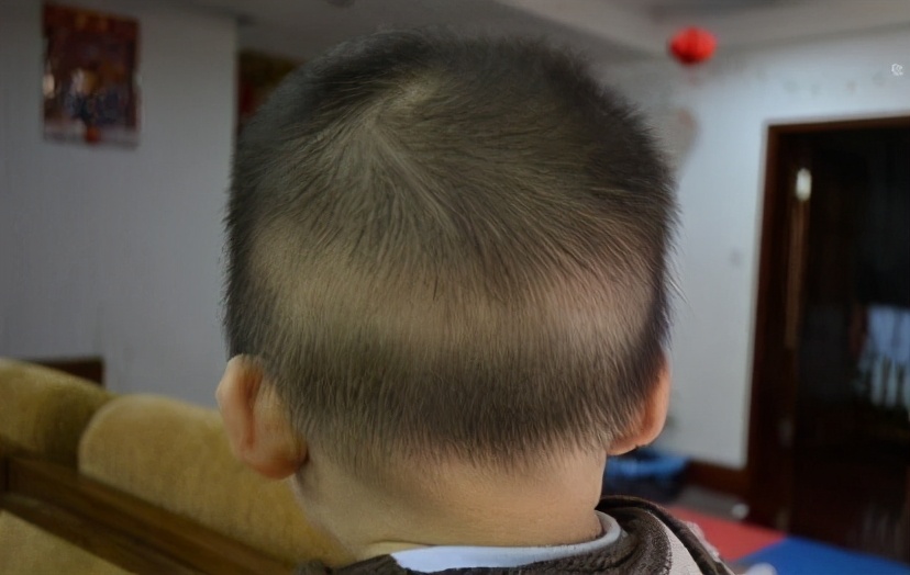 孩子缺钙别着急科学补钙就看这里,宝宝缺钙怎么补救最有效