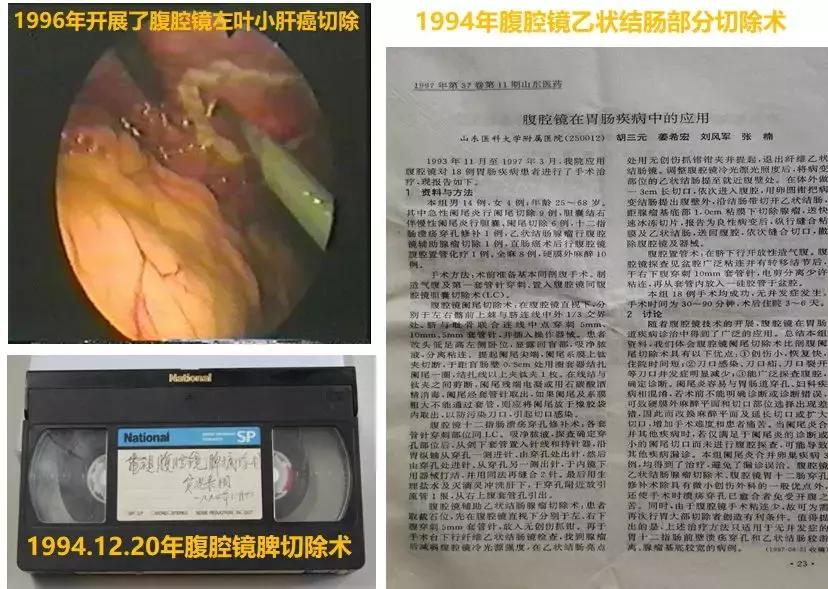 腹腔镜微创手术是高难度吗,腹腔镜技术在妇科的发展