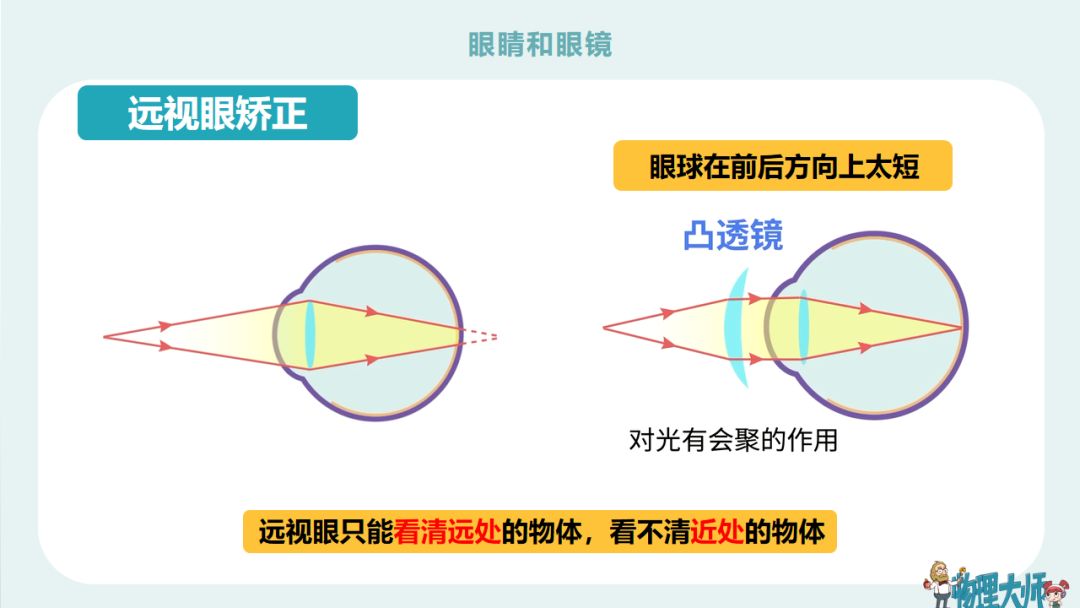 初二物理眼睛与眼镜难题,初二物理眼睛与眼镜讲解视频