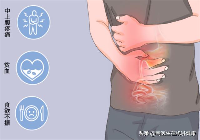 几年都在服用二甲双胍,真的不会损伤肝肾吗?听听医生怎么说