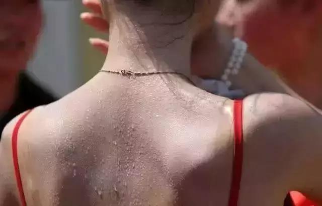 鸡皮肤的人夏天怎么办,夏天去鸡皮肤有效的方法