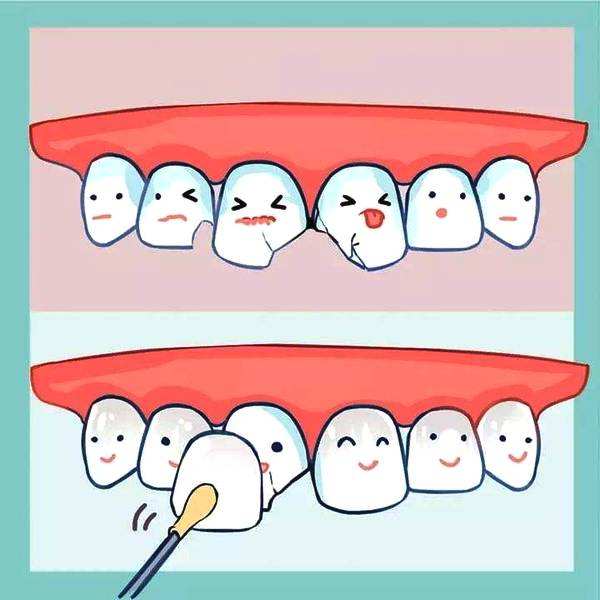 牙科诊所里你不知道的事,口腔医生提醒