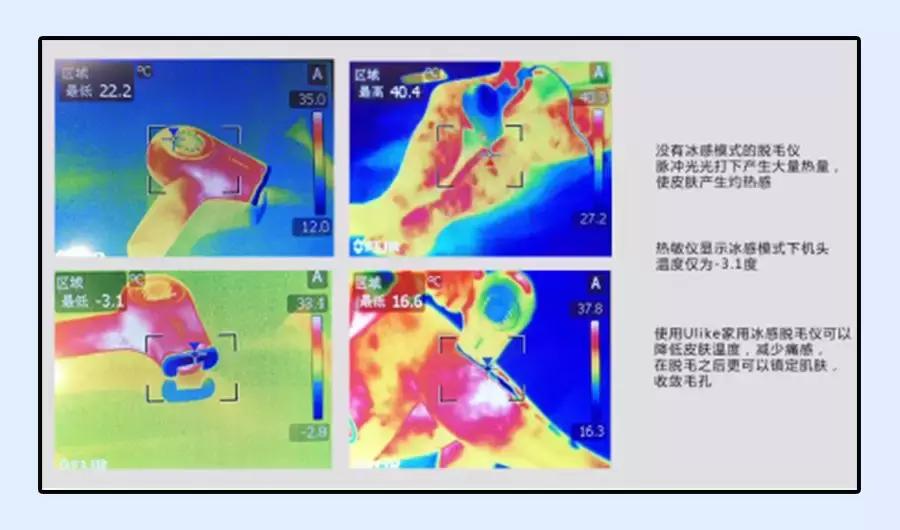 土方脱毛最有效的方法,简单又不用花钱的脱毛方法