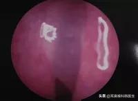 为啥来院就做内镜检查?医生怕是在骗我钱吧