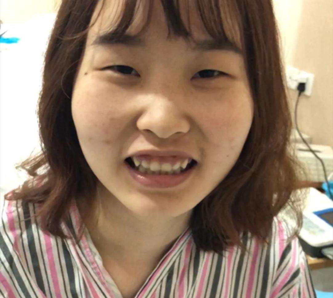 祛痘痘的产品价格多少合适,平价祛痘痘10元以下