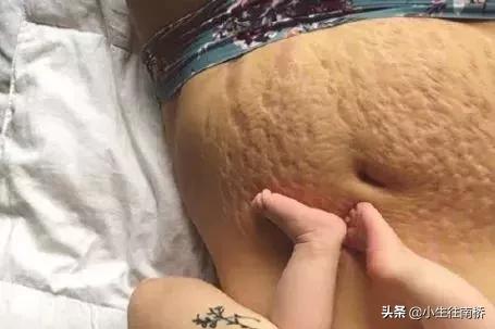 38岁天后自曝产后尿*禁失**:女人拿命生孩子,图什么?!