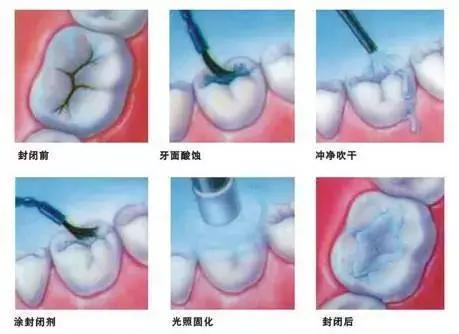 Helen榻跨涓績,helen榻跨