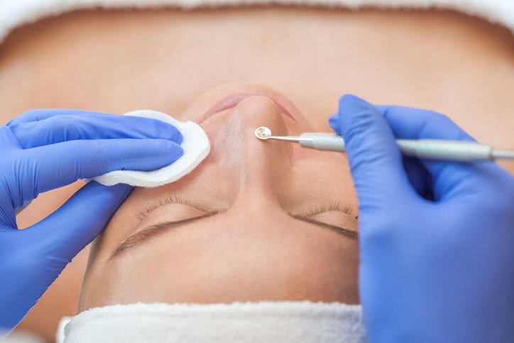 用黑头针去黑头的正确方法,去黑头的针正确护理方法