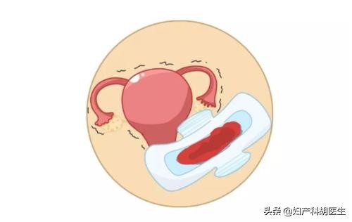大姨妈才是19天来正常吗,大姨妈来了不痛真的正常吗