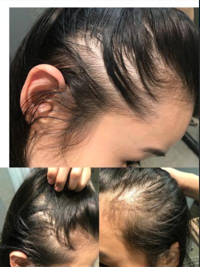 关于护肤曾经踩过的雷,那些年护肤踩过的雷