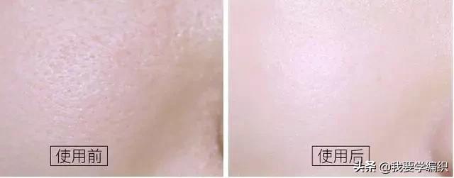 冬天脸干,连皱纹都出来了?日本女博士教你一招,抹几下白白嫩嫩