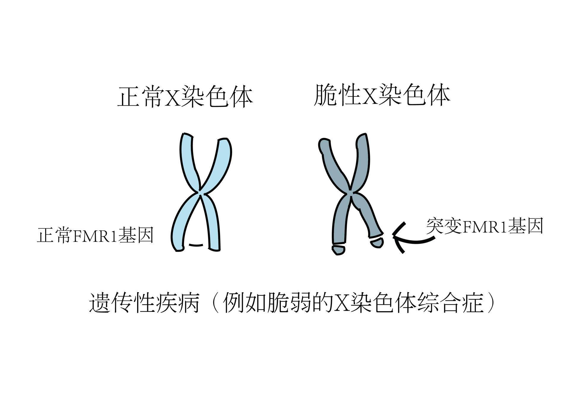 星星的孩子自闭症儿童心理特征,星星的孩子自闭症截图