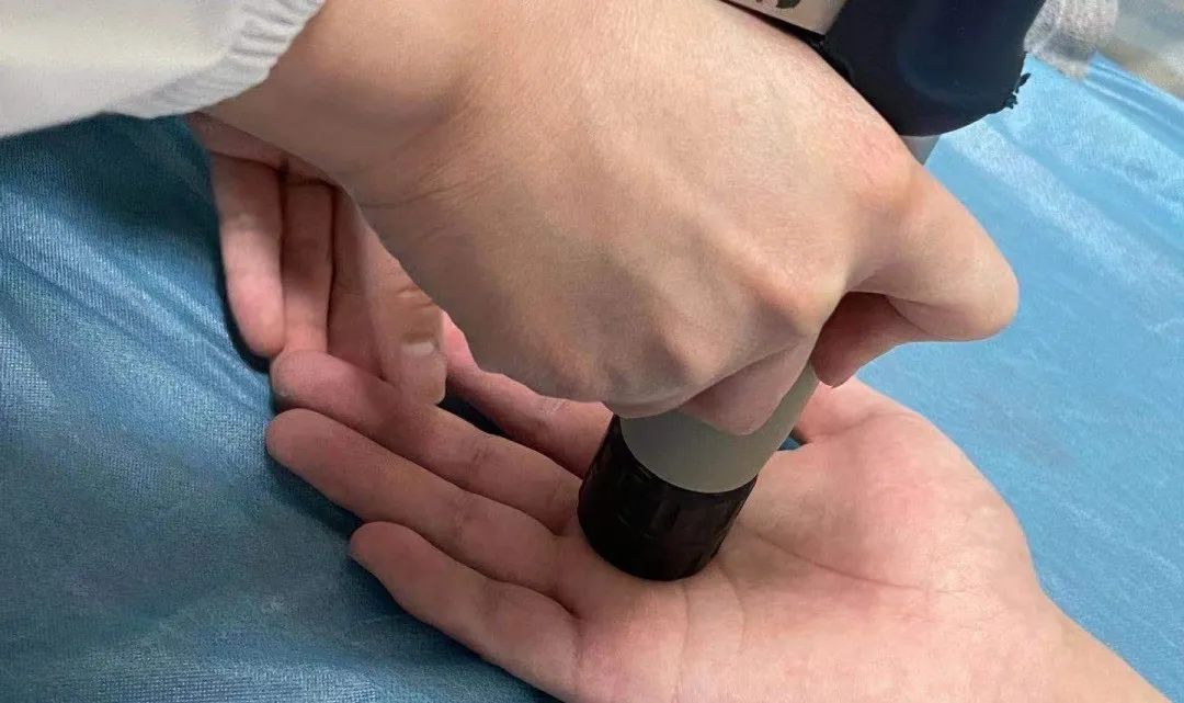 康复科冲击波效果好吗,康复科的冲击波是什么作用