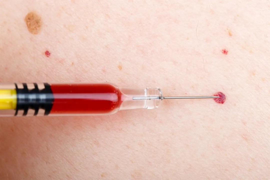 身上长了红点看什么科,身上长出这种小红点要小心