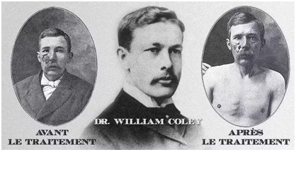 免疫治疗与中药的区别,免疫治疗药都一样吗