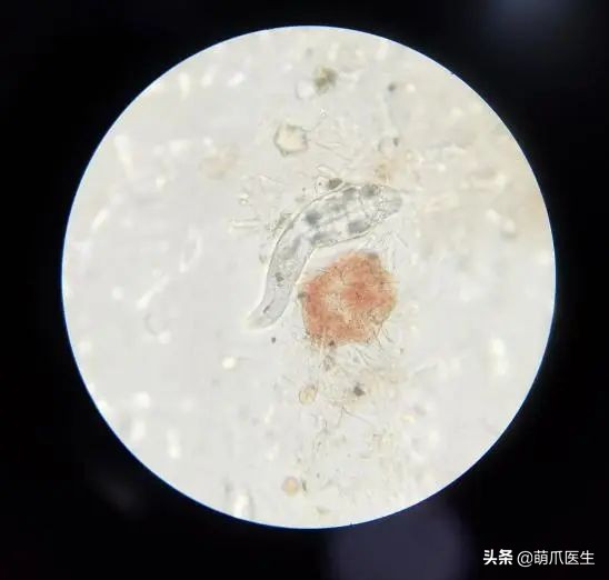 猫咪过敏是属于炎症反应吗,猫咪过敏怎么排除过敏源