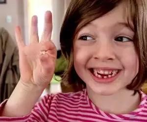 口腔换牙知识讲座,儿童牙科口腔知识