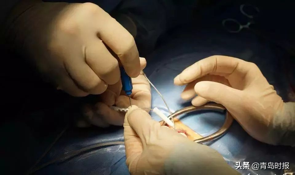 青岛普及无痛分娩了吗,青岛无痛分娩哪个医院好