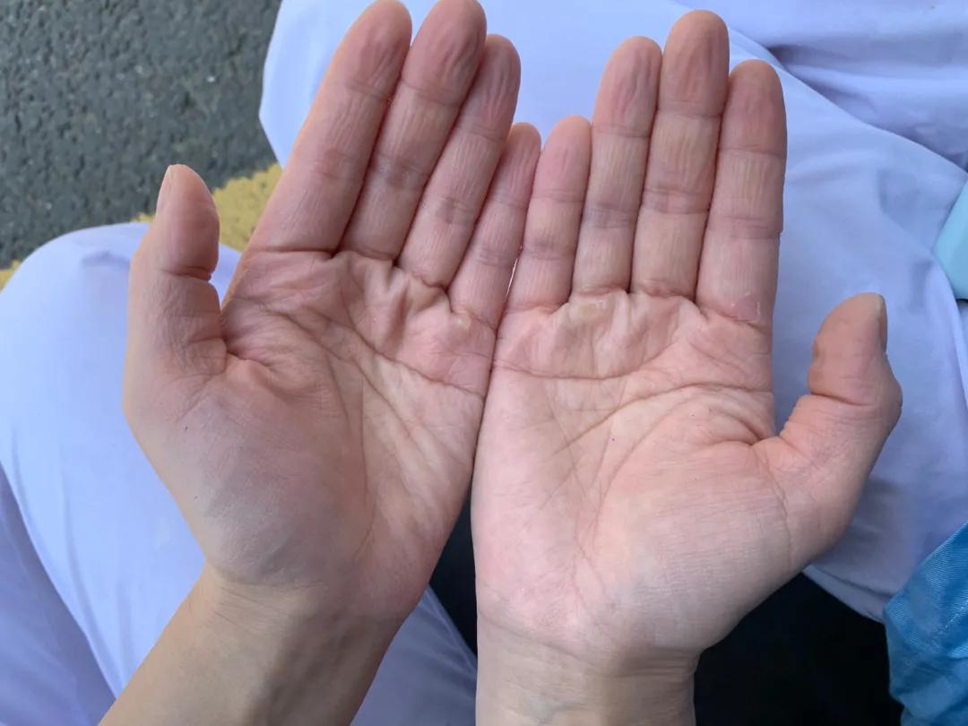 驰援抗疫情,扬州南京疫情