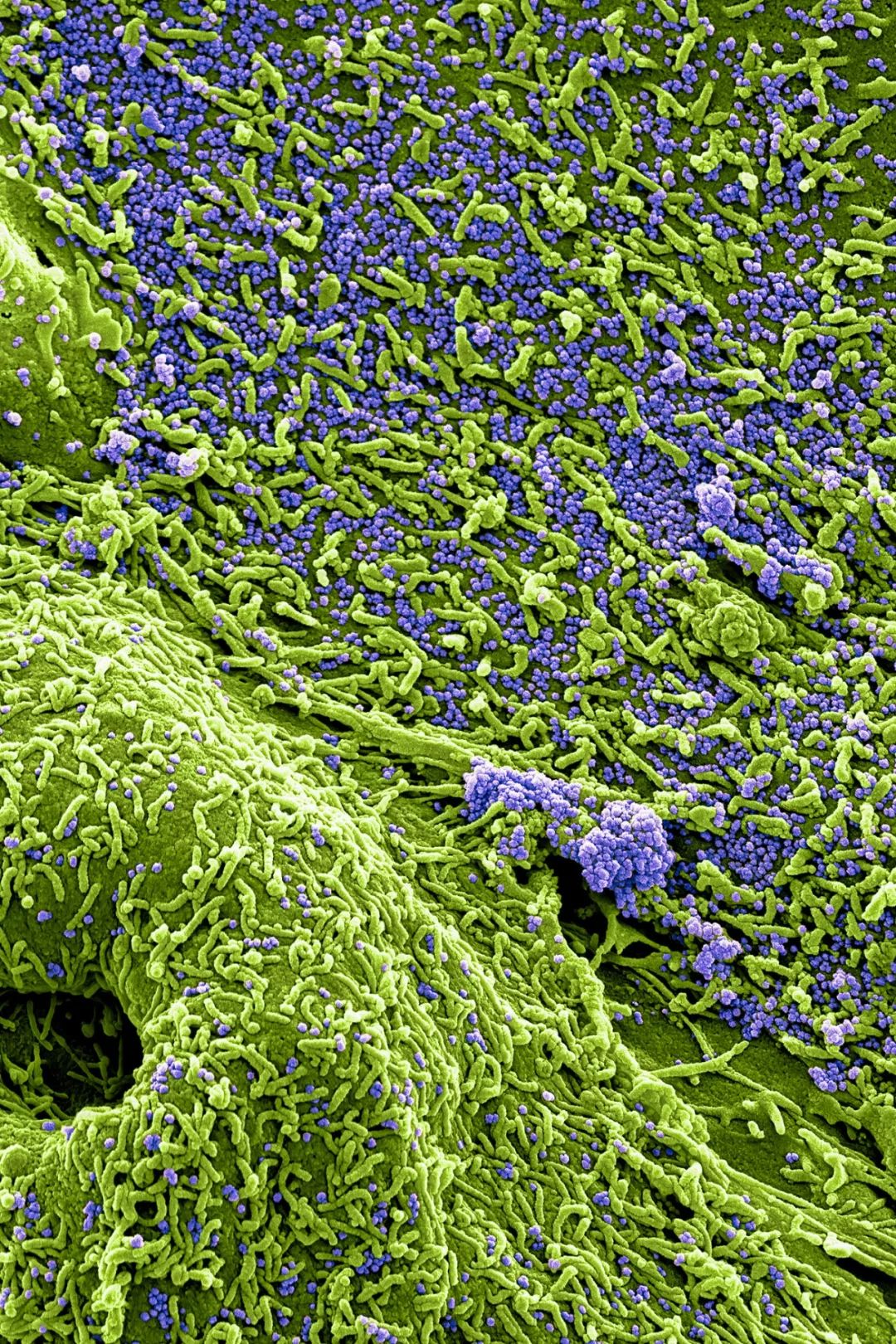 感染病毒后的168小时,你的体内都发生了什么?