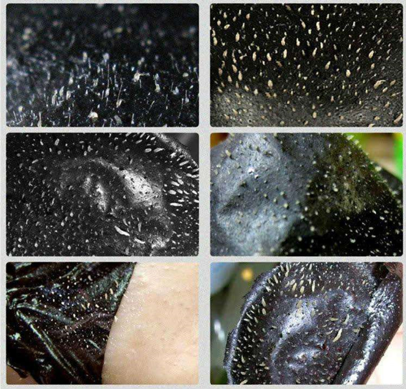 我的脸就是被撕拉坏了，撕拉一时爽，爽完就后悔了