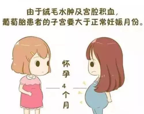 什么是葡萄胎？准妈妈怎样尽早发现？