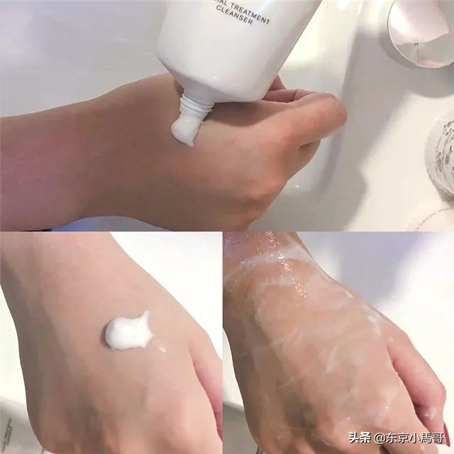 sk2神仙水敏感肌肤二十一岁适合吗,日本sk2护肤品怎么样好用吗