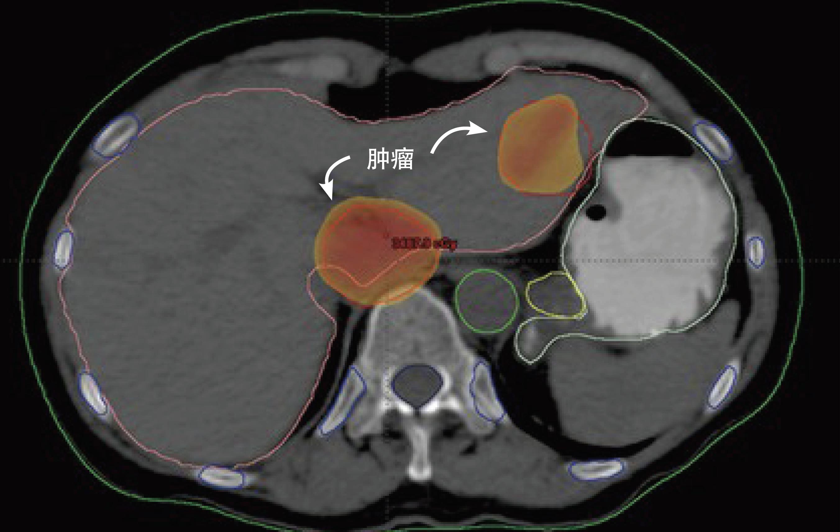 “永生”的拉克斯：身患绝症却成研究对象，被科学界无偿利用70年