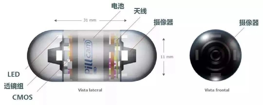消化道胶囊内镜,消化道里的摄像头